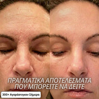 Στικ Αναδόμησης με Bio-Κολλαγόνο & PDRN