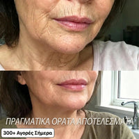Στικ Αναδόμησης με Bio-Κολλαγόνο & PDRN